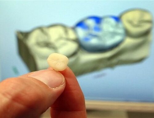 COVID-19 May Cut Dental Services Spending for 3 Years: Actuaries