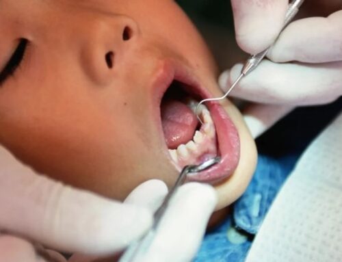 Pandemic Has Affected Kids’ Dental Health: Poll