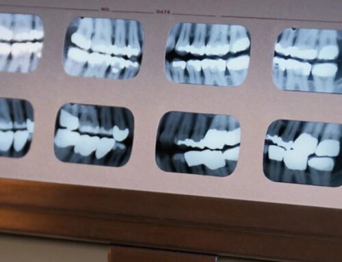 Tense Times Mean More Tooth-Grinding, Dentists Warn